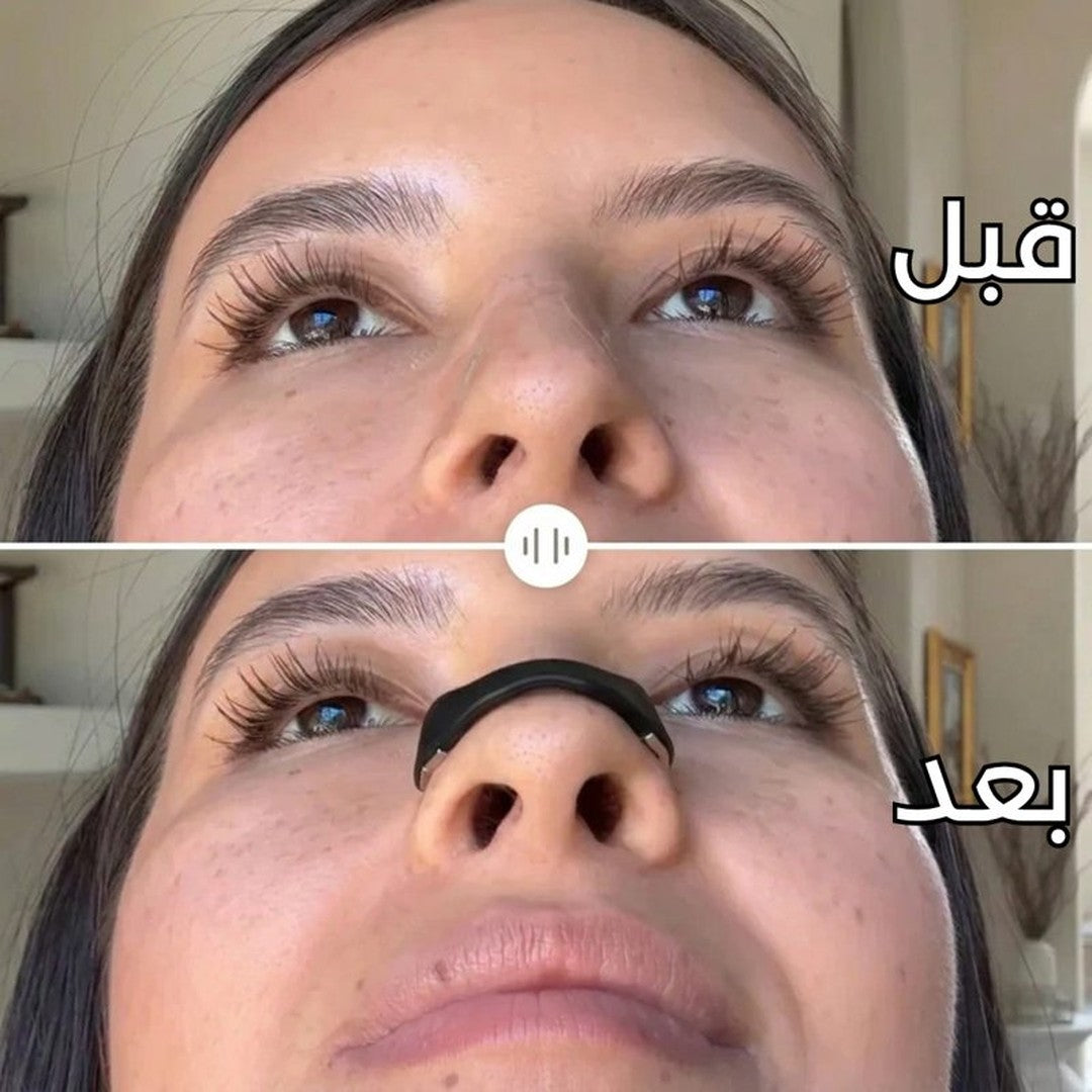 04-ns-ba